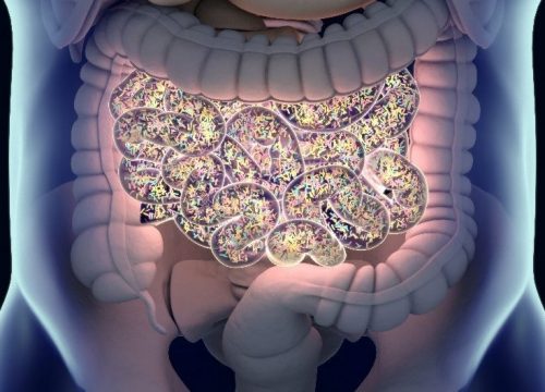 X-ray image of intestines